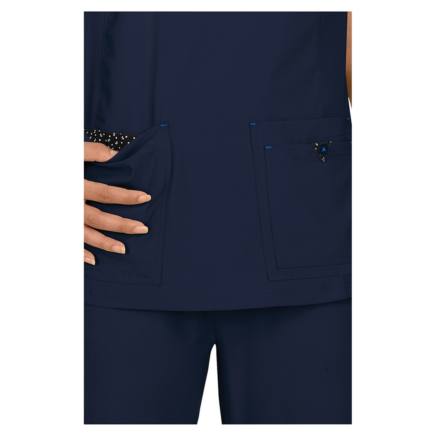 374 koi Basics Katie Top